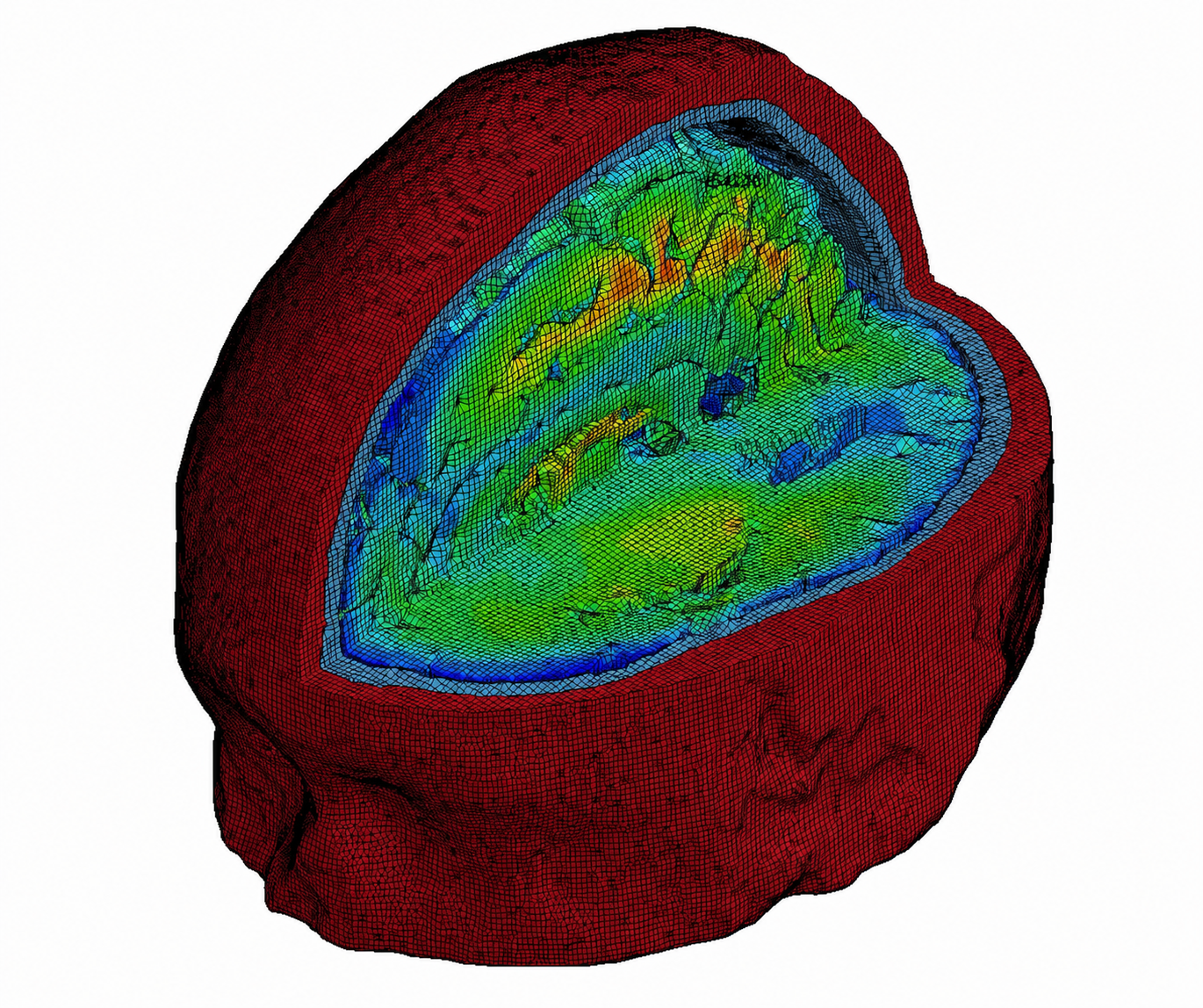 brain-strain-ic-model.jpg